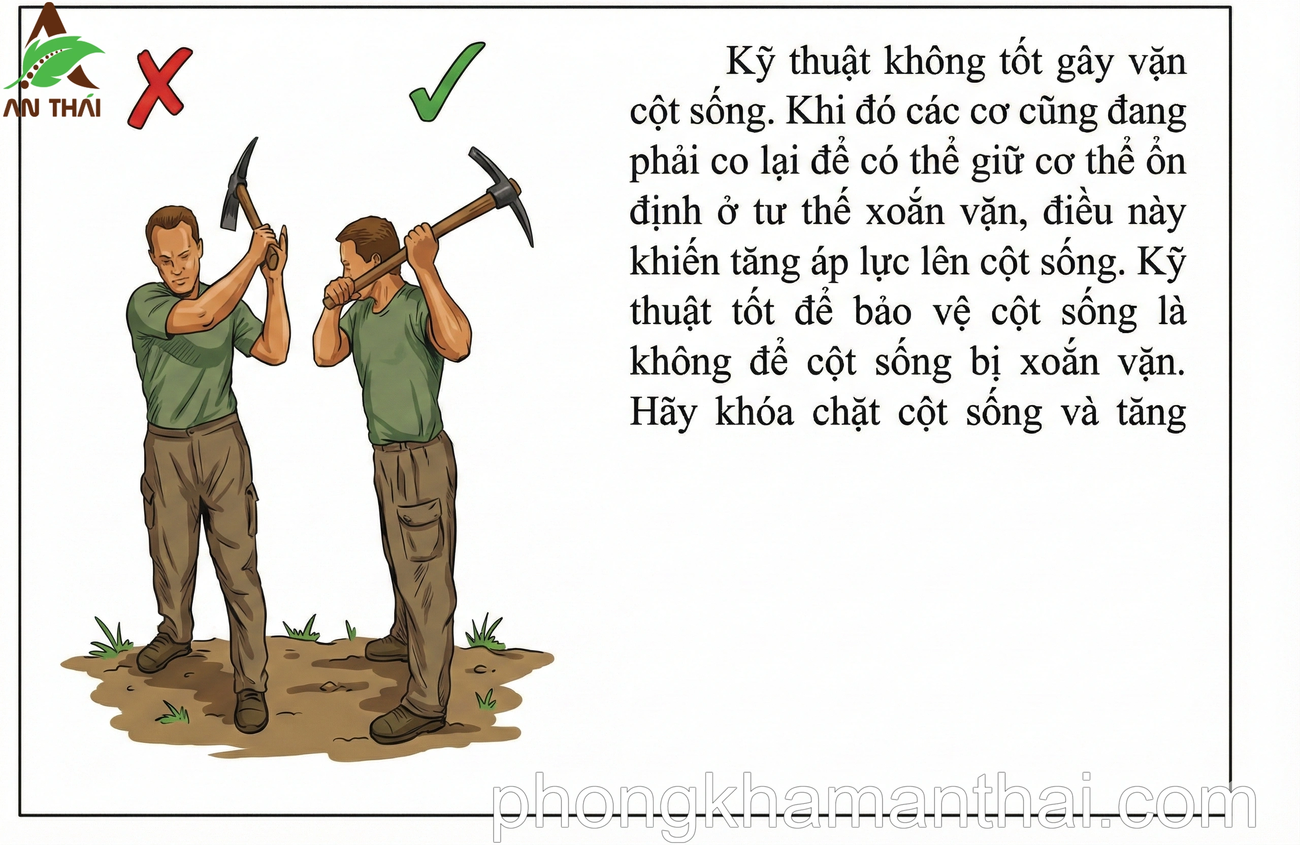 Không vặn xoắn